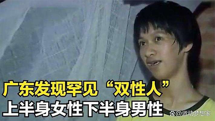 女性分泌物为黄色正常吗的相关介绍